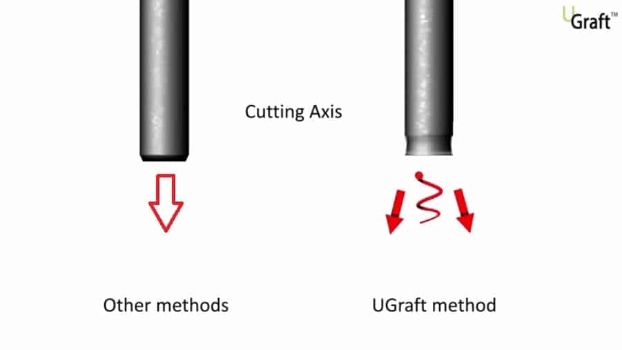 The Dr UGraft procedure uses special tools designed by Dr. Umar himself