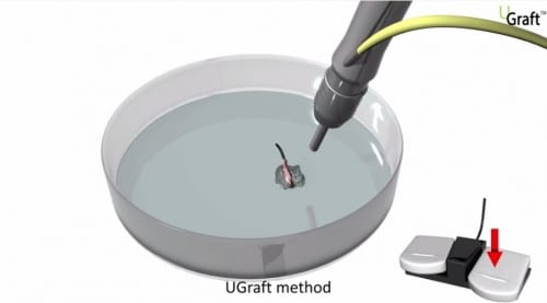 Technical illustration of surgery with the DrUGraft