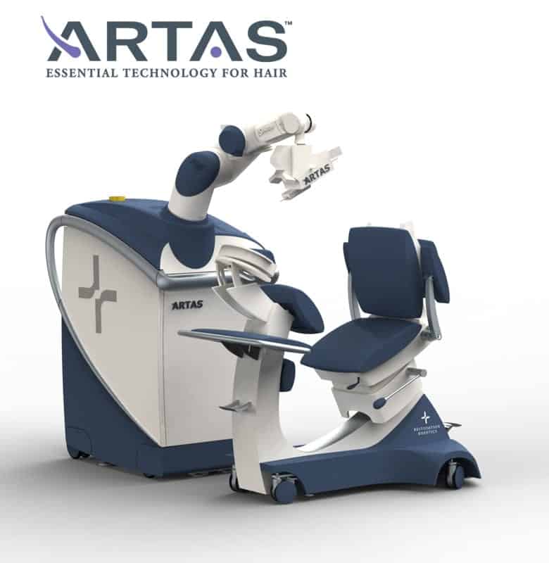 ARTAS automated FUE hair transplant method ARTAS automated FUE hair transplant method