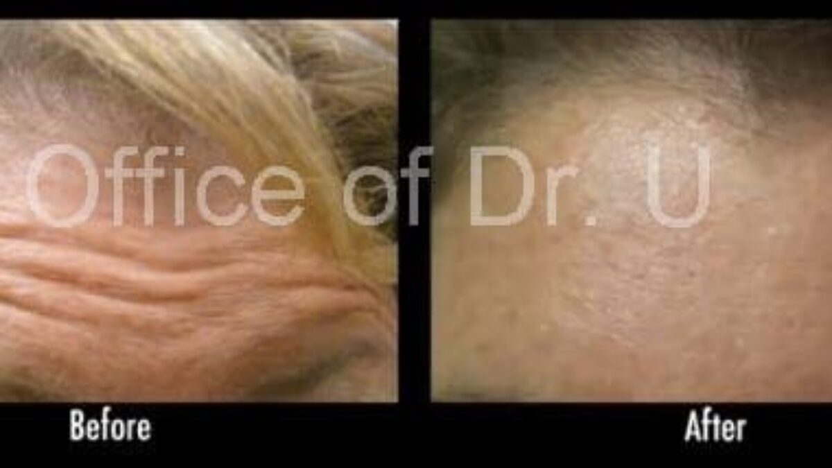 Skin Clinic Wrinkle treatment Dr. U Hair Skin Clinic FUE