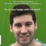 Patient Result Photo - Dr.UGraft Norwood 1 Forehead Size Reduction Hair Transplantation Patient Result Photo - Dr.UGraft Norwood 1 Forehead Size Reduction Hair Transplantation