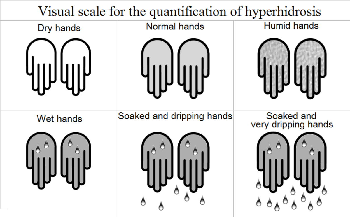 facial hyperhidrosis