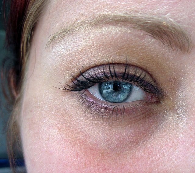 Under Eye Bags, Puffiness Under the Eyes Causes - Dr. U