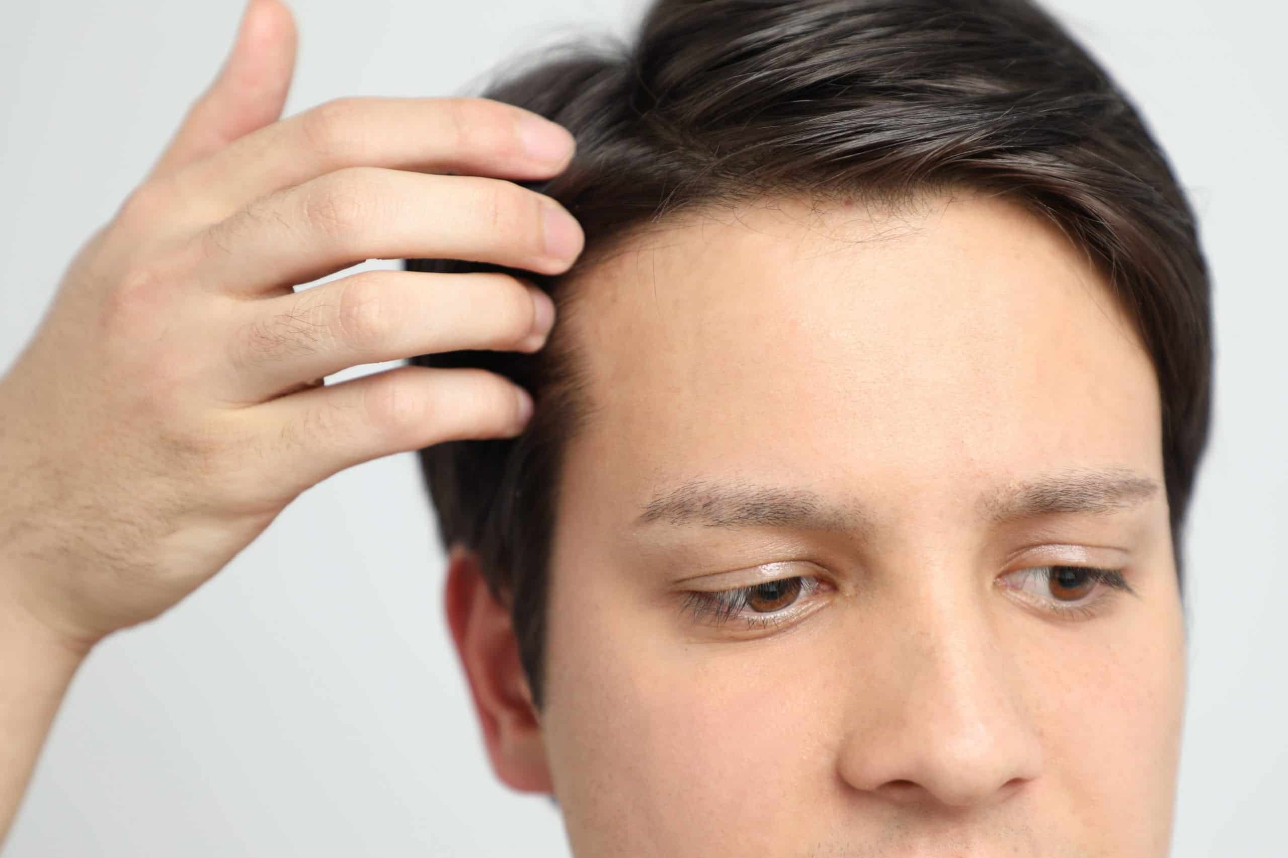 Male Hairpiece Usage And Its Social Pitfalls Wearing A Toupee