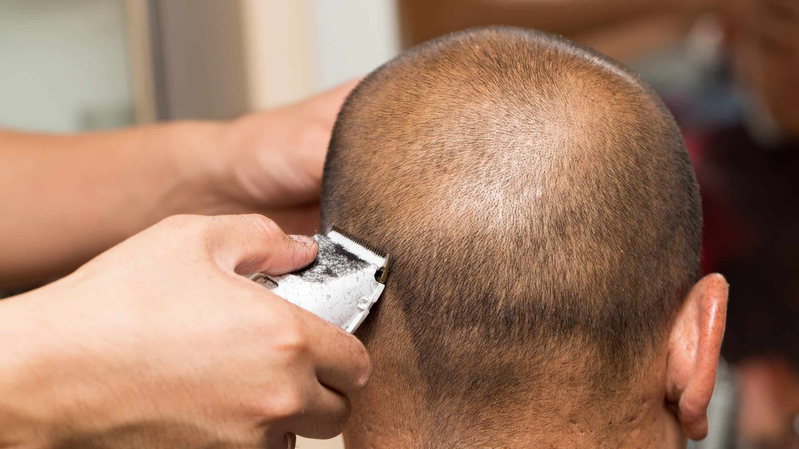Video Those Bumps On Your Head May Be More Serious Than You Think