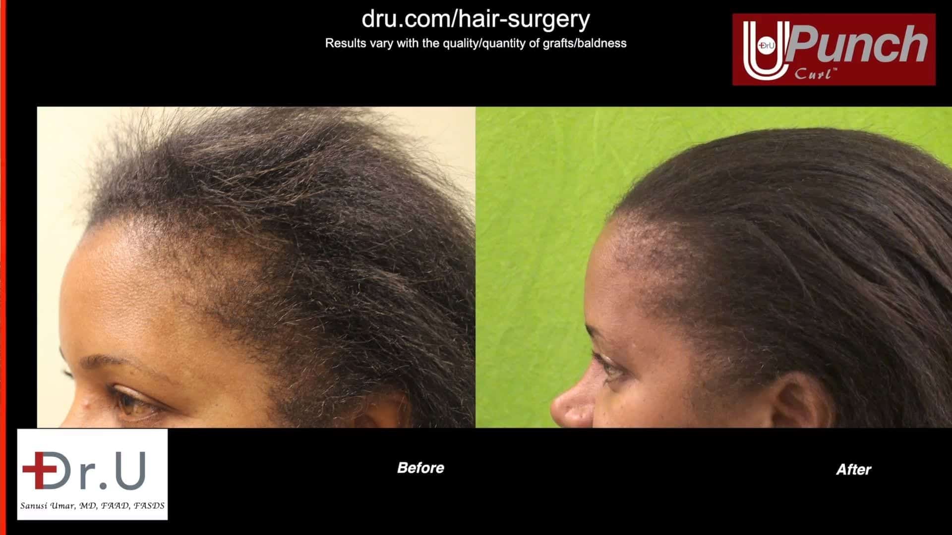 Meet Dr. Umar - Dr. U Hair & Skin Clinic