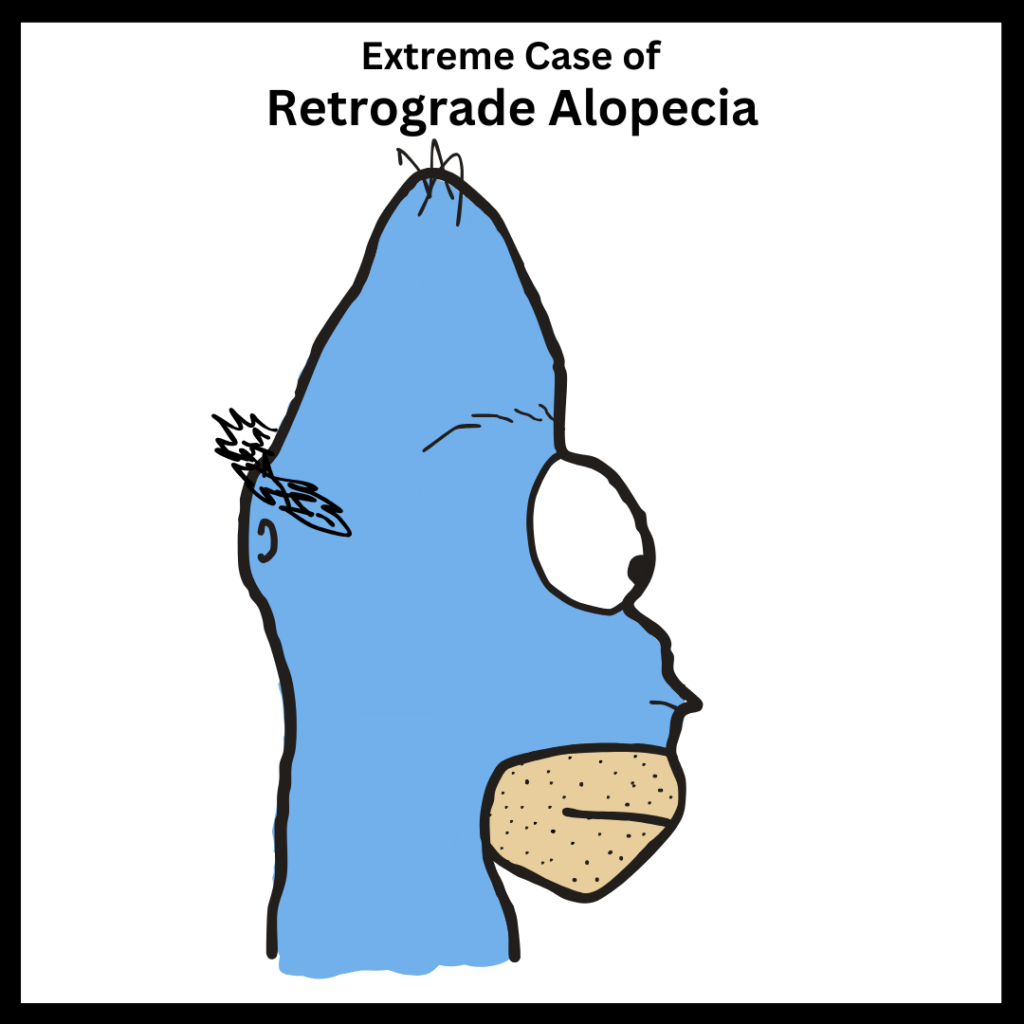 A cartoon character who has a severe case of retrograde alopecia.