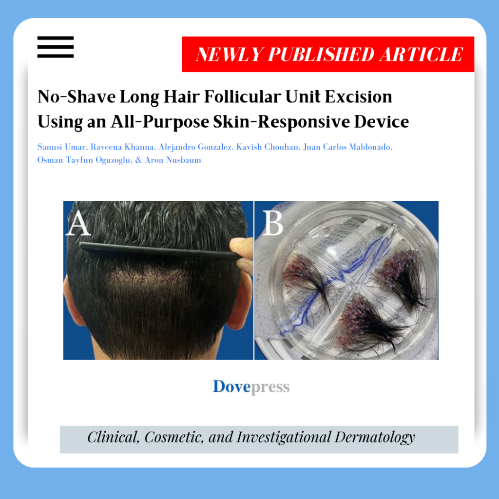 Our study on long hair transplants is published in the esteemed Clinical, Cosmetic and Investigational Dermatology journal.