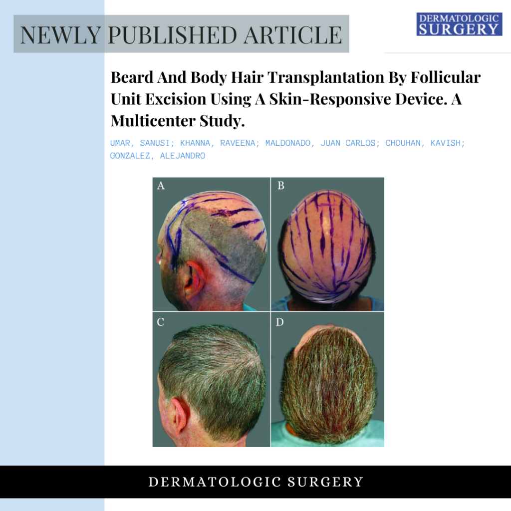 Read this study on body hair transplant (BHT) by Dr. U Hair and Skin published in the Dermatologic Surgery.