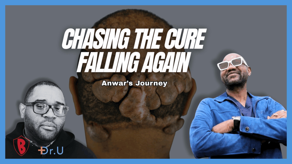 Chasing A Cure, Failing Again: Anwar’s Final Attempt At Getting Rid Of Folliculitis Decalvans