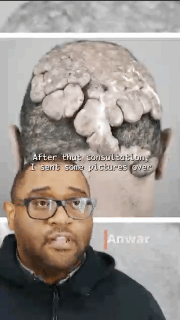 Anwar explains how he first got hold of Dr. Sanusi Umar online through the Dr. U Skin and Hair Clinic online consultation form. In today’s modern world, proper care and medical intervention can start as easily as pressing a button on a website.