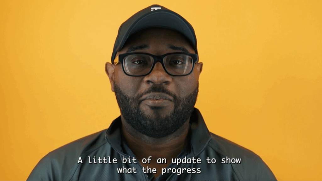 Alt Text / Caption/image title attribute:
Anwar has been happy with the results of his successful surgery. He talks about the reveal of his scalp’s progress.