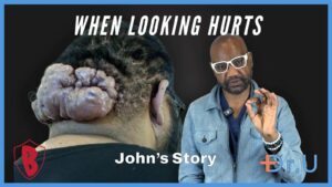 When Looking Hurts: John's Journey to Recovery from Painful Scalp Lumps 
