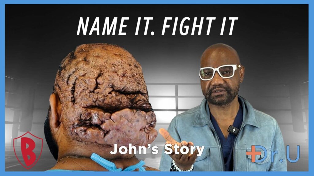 Naming and Fighting the Chronic Hairline Bumps