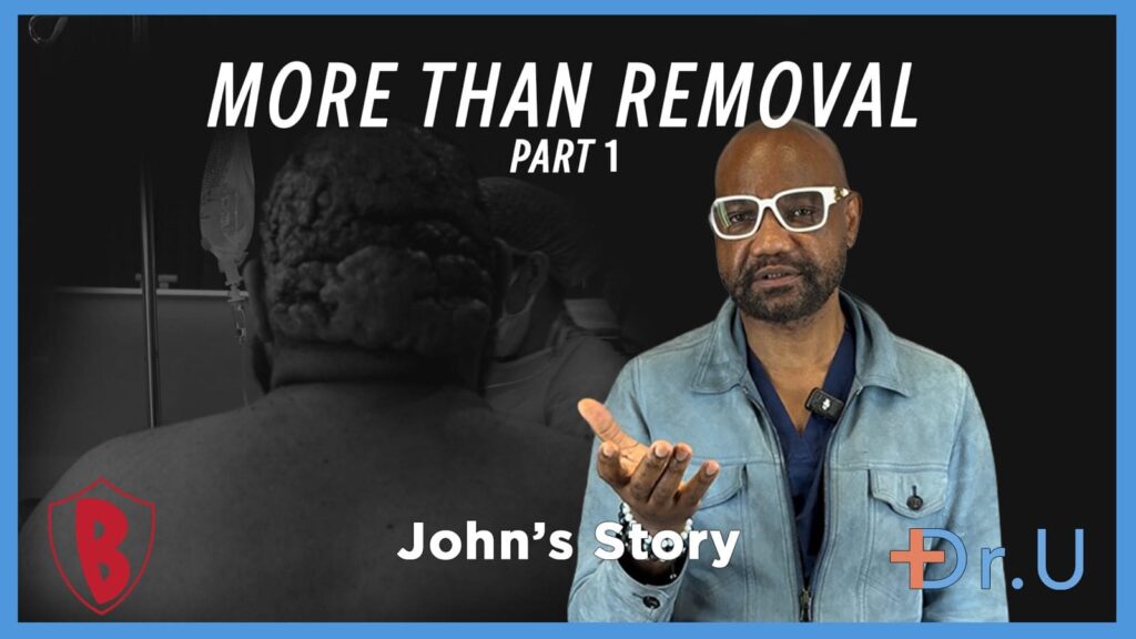 More Than the Removal of Posterior Scalp Scarring Disorder (Part 1)