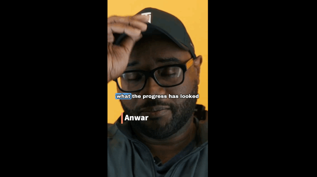 Anwar’s scalp bumps were removed and he is now healed after the surgery. Now, he is ready to show the excellent progress of his now healthy scalp.