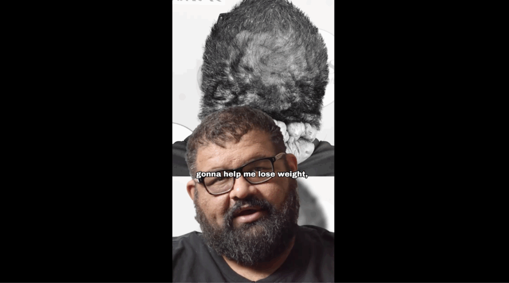 John states how excited and amazed he is when Dr. Umar mentioned that he is also going to help him lose weight, which has been an on-going problem to him for years.