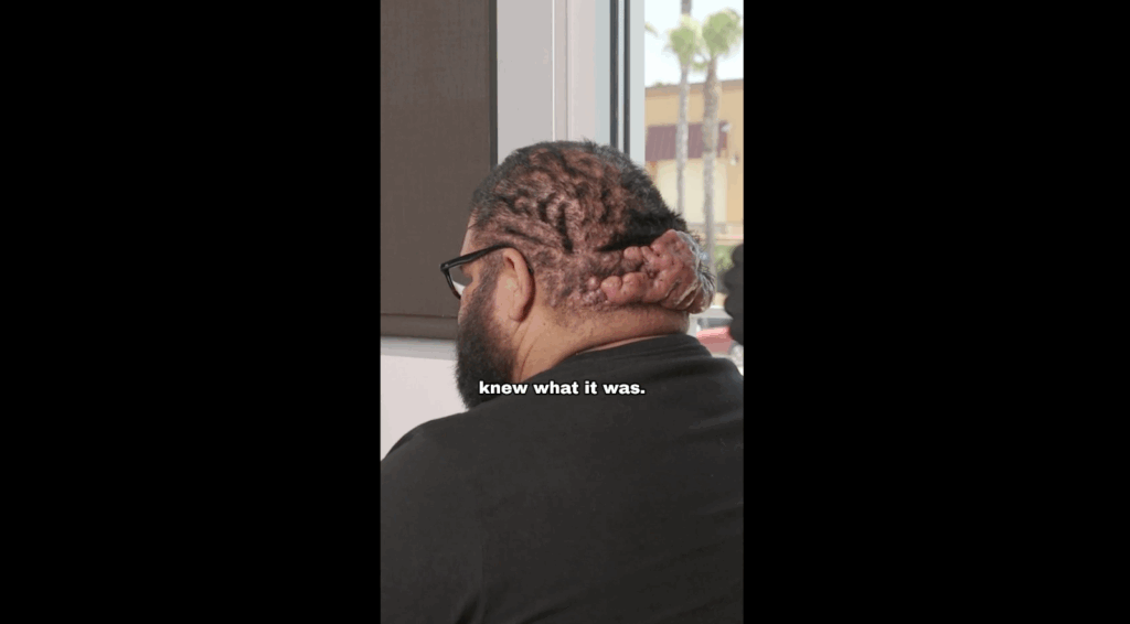 Dr. Sanusi Umar is checking John’s scalp and he immediately knows the scalp conditions that he currently has.