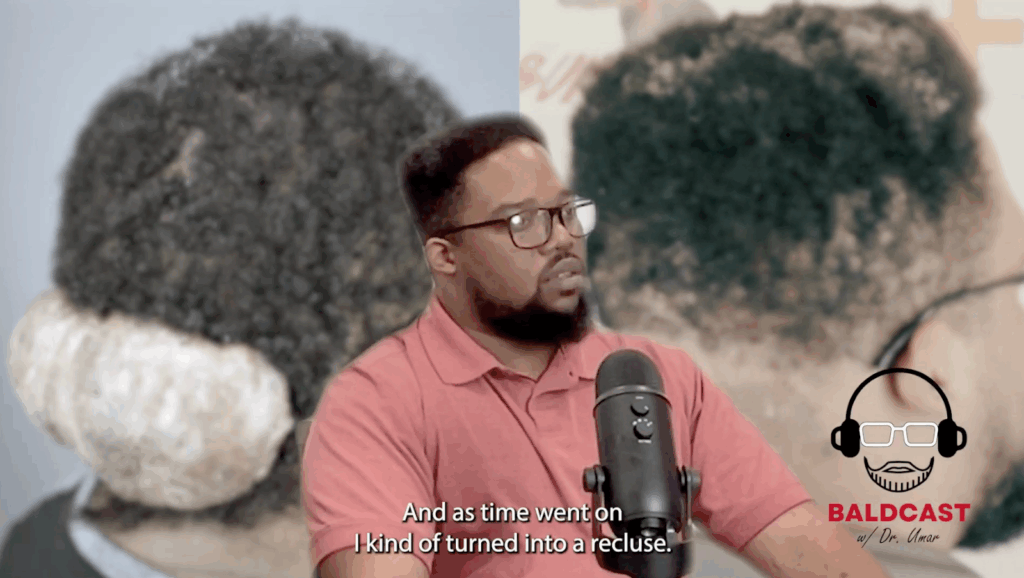 As Adrian’s AKN scalp bump grew, his social life shrank. He avoided people and eventually turned to isolation. 