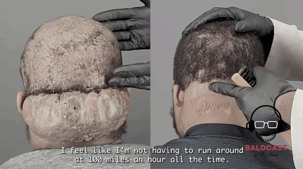 Now, Adrian can relax knowing that his AKN won’t be coming back, thanks to Dr. Sanusi Umar.