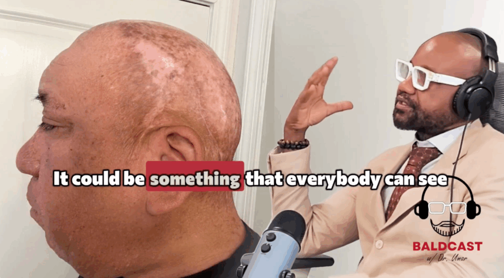 After five years, the scalp bumps are gone, and Robert has a smooth scalp with no sign of recurrence. 