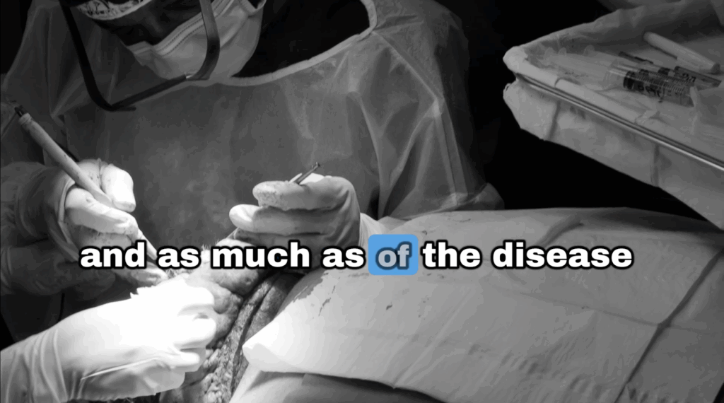 Dr. Umar is removing as much of the diseased area of John’s scalp scarring disorder.