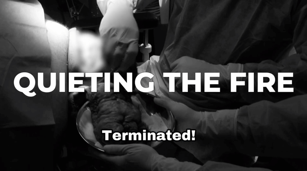 Dr. Sanusi Umar has finally removed the diseased bump on John’s scalp.