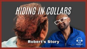 Living With Severe Hairline Bumps: Robert’s Early Coping and Scalp Changes