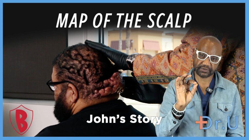 map of the scalp
