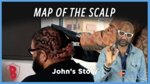 map of the scalp