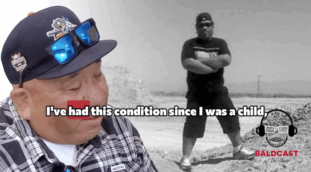 Robert tells Dr. Sanusi Umar that he noticed the symptoms of his scalp cysts since he was a child, and has been living with it until he’s 43 years of age.