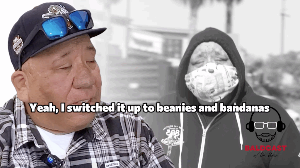 Beanies and bandanas have been Robert’s staples in hiding his scalp disorder from the public eyes.