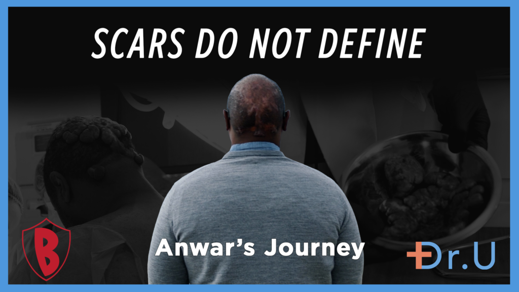 Scars Do Not Define: An Acne Keloidalis Nuchae Patient Success Story