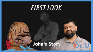 Impact from Scalp Keloids on the Life of John
