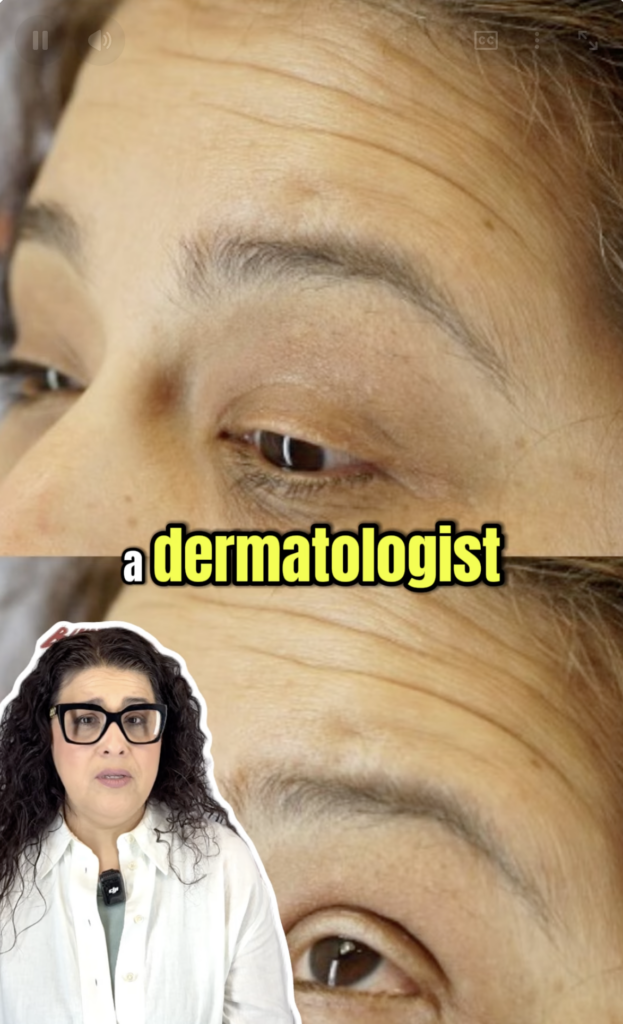 Vertical video frame with a close-up of Lizette’s eye and eyebrow and a presenter inset in the lower-left corner.