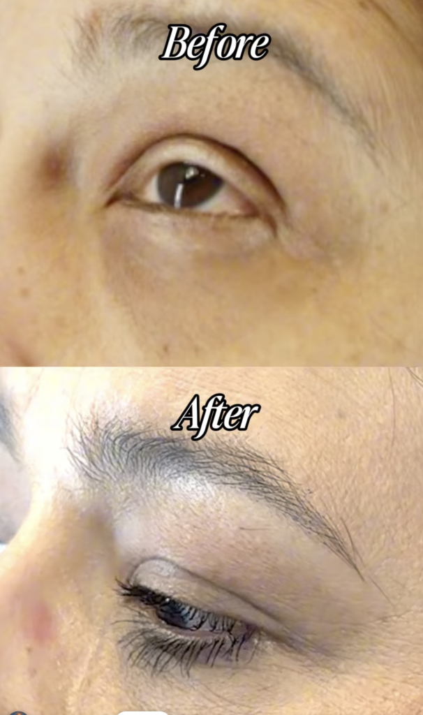 Close-up Before and After views of Lizette’s eye area, including her upper eyelashes and eyebrow.