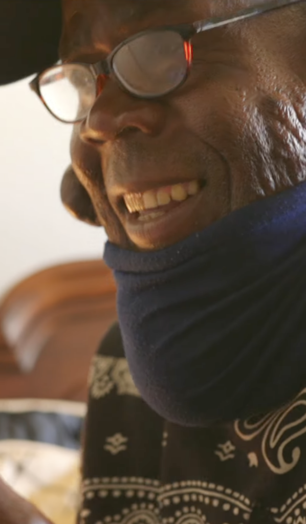 Close-up of a smiling man wearing glasses, a dark cap, patterned shirt, and navy neck covering, with a raised growth visible beside his face.