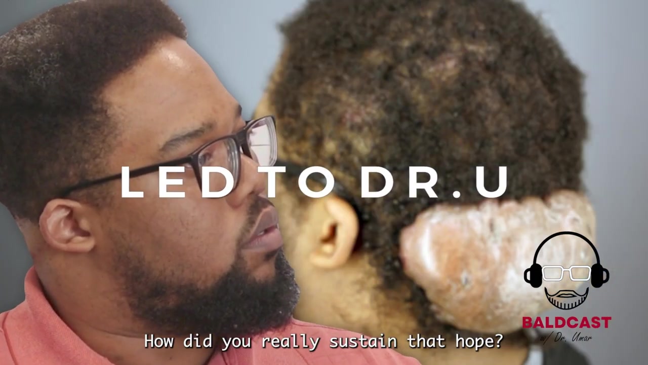 Finding Hope Again with Posterior Scalp Scarring Disorder | Adrian's Journey