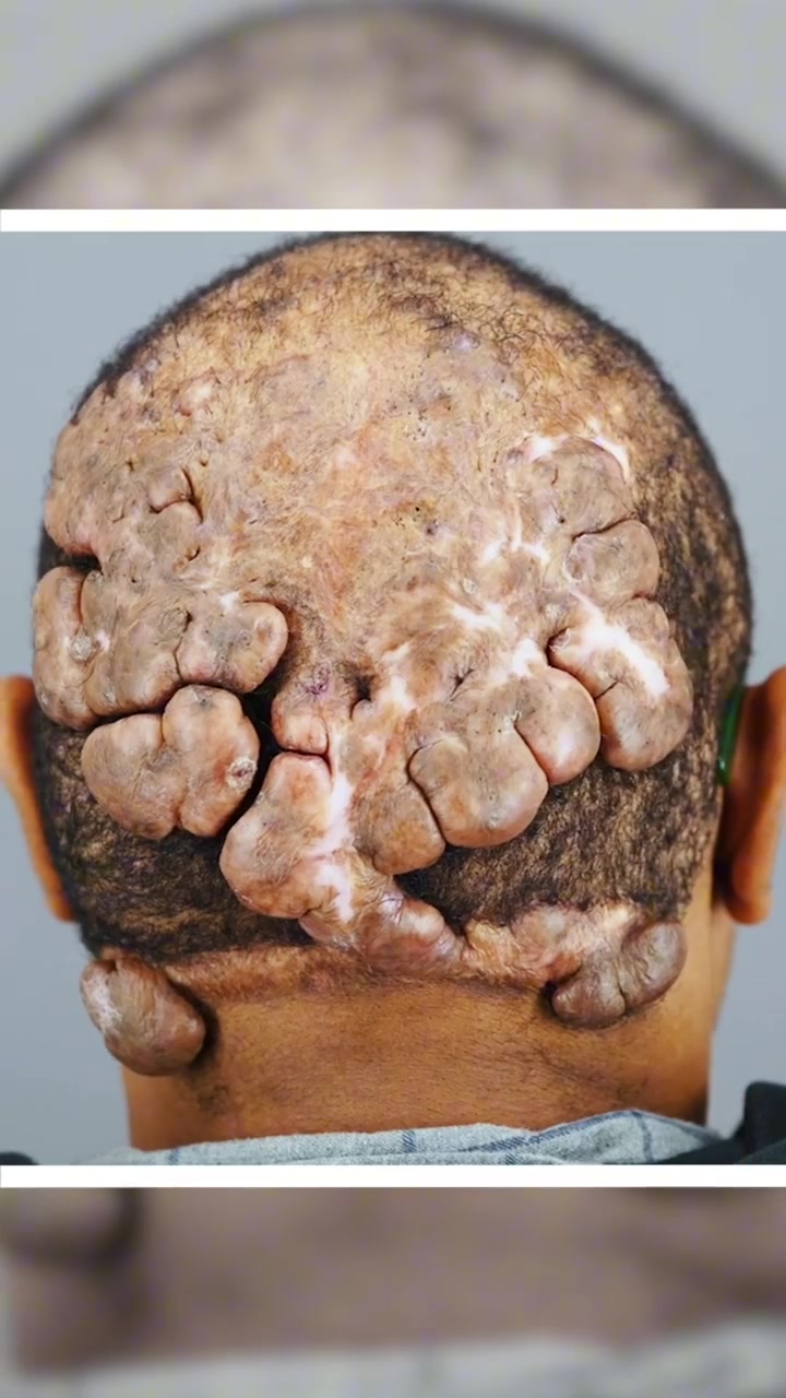 Anwar’s 16-Year Battle With AKN | The Weight of 16 Years #shorts #reels #series #documentary #fyp