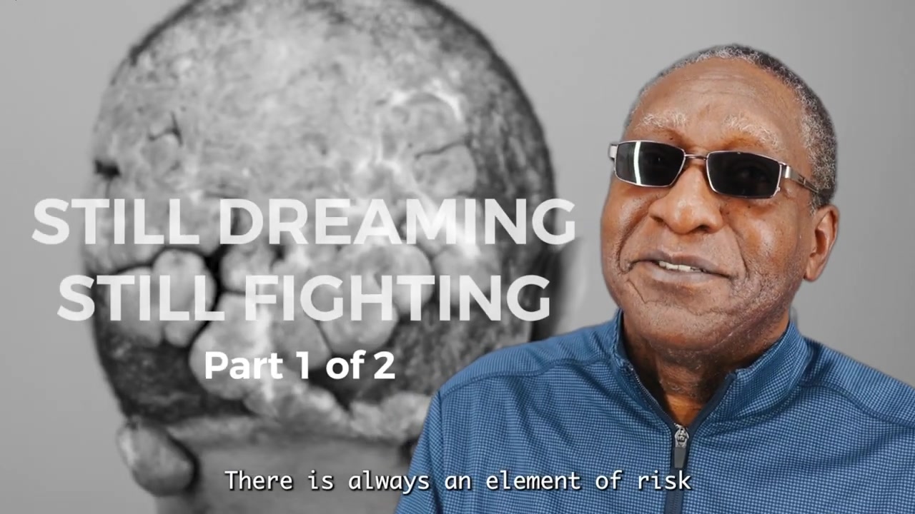 Being Seen Beyond Posterior Scalp Scarring Disorder Part 1 | Anwar’s Journey