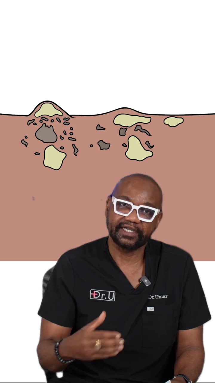 Q+A: What Condition Does Kevin Have?