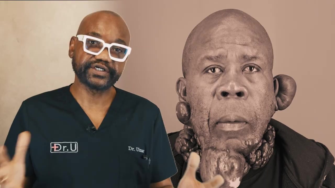 When Treatments Fail: Dissecting Cellulitis and a New Keloid Treatment Approach