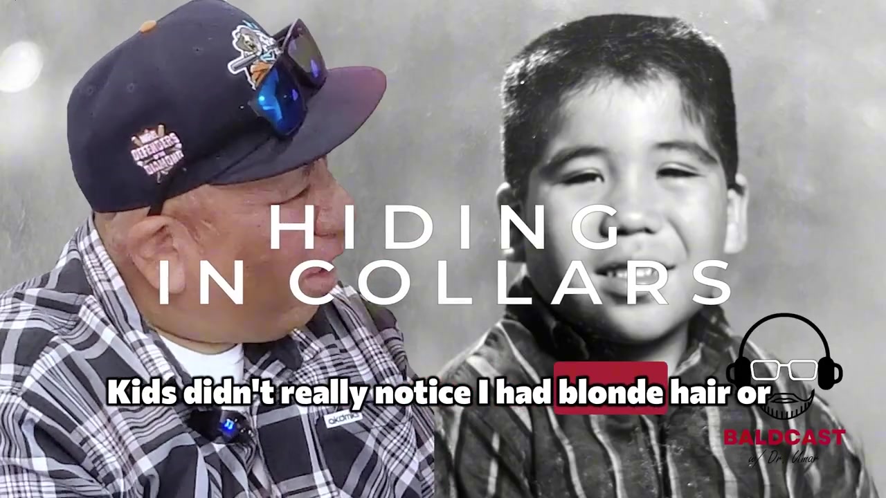 The Hidden Scalp Battle: Tufted Hair and Keloid Scars | Baldcast Chapter 2