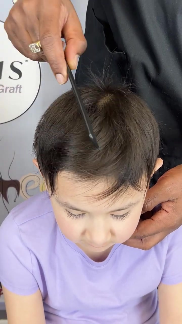 Mia Started Seeing Hair Growth Around Month Four