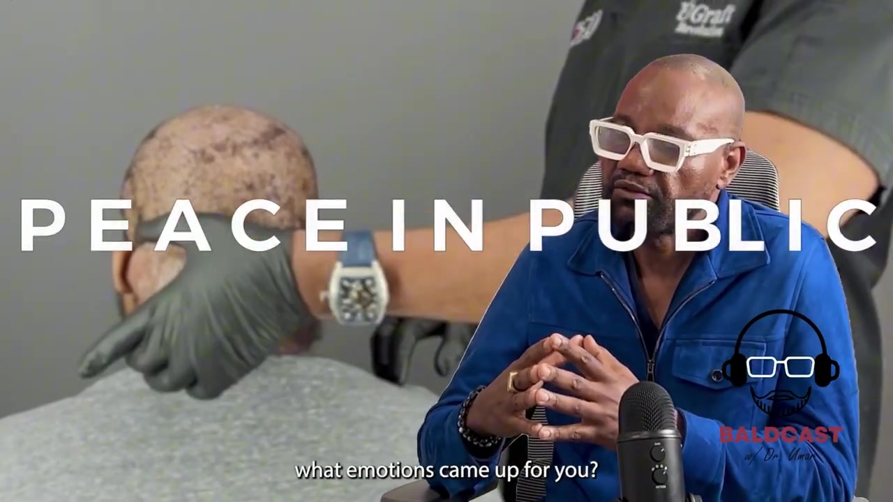 Experiencing Peace in Public without Cicatricial Folliculitis | Adrian's Journey