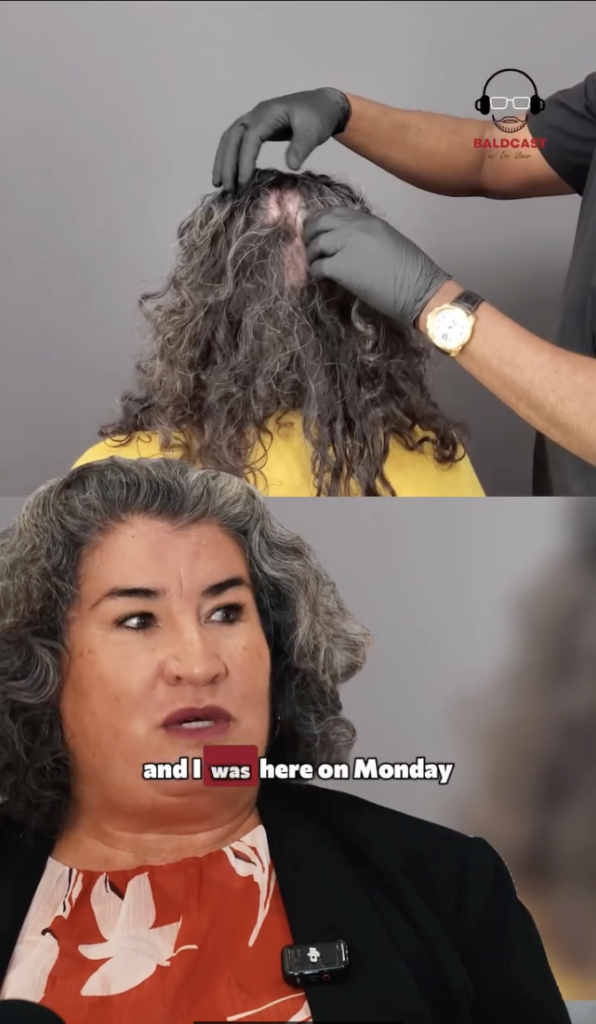 Split-screen image showing gloved hands parting a woman's gray hair to view her scalp above and Maria speaking below.