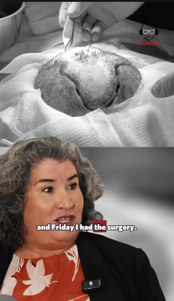 Split-screen image showing a black-and-white close view of a scalp procedure above and Maria speaking below.