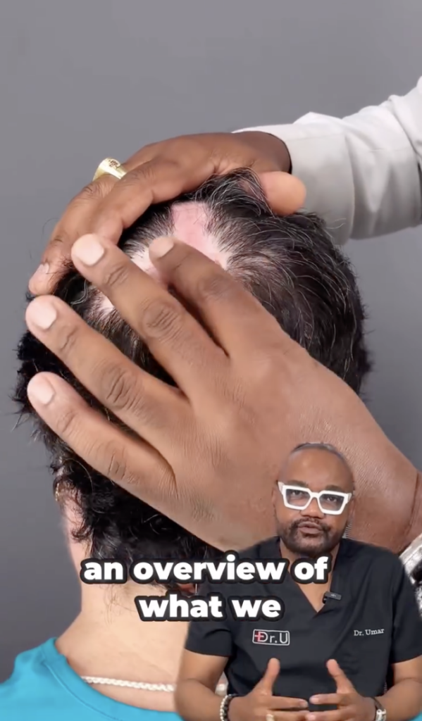 Close-up view of hands parting dark hair to expose an area of scalp, with Dr. Sanusi Umar overlaid in the lower right.