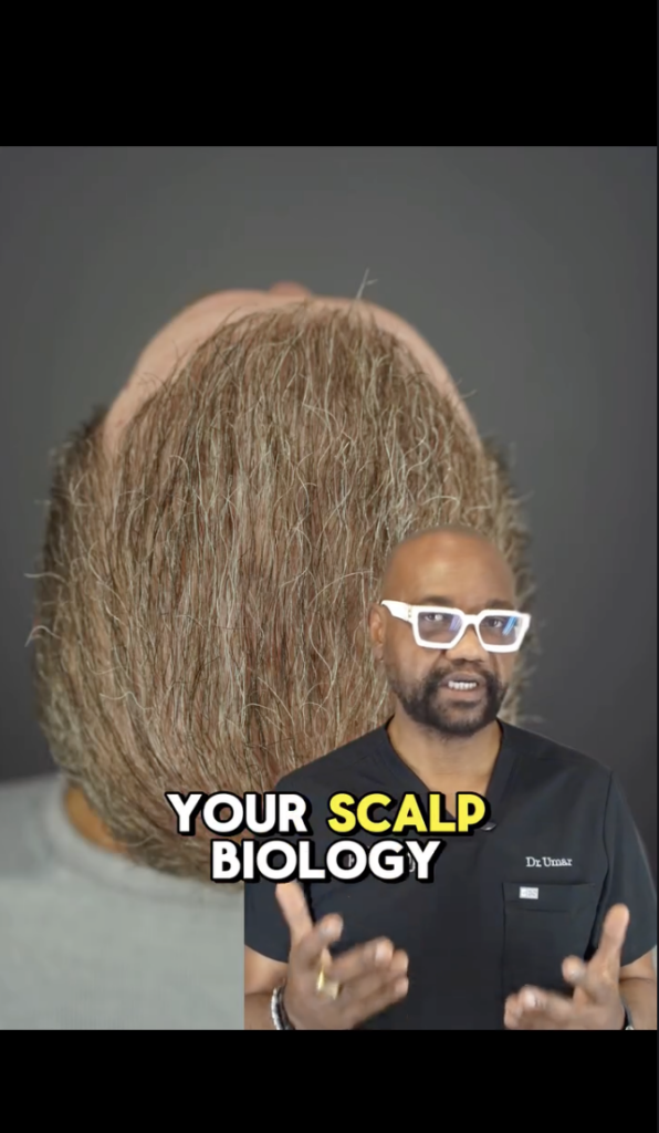 Rear view of a person with thinning hair over the scalp, with Dr. Sanusi Umar speaking in the foreground.