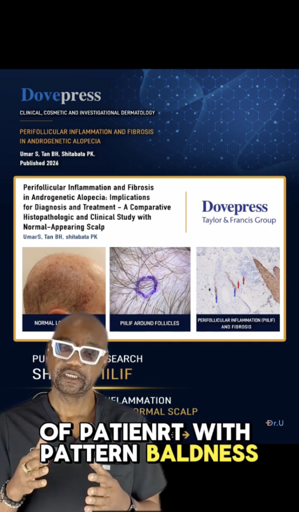 Dr. Sanusi Umar speaking below a medical-research graphic about perifollicular inflammation and fibrosis.